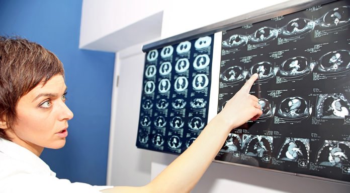 Loma Linda University Health earns accreditation from Pulmonary Hypertension Association