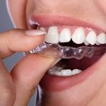 How dental innovations help your overall health clear aligners