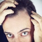 Avoid hair loss in stressful – and other – times hair loss
