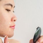 Remedies for common skin issues