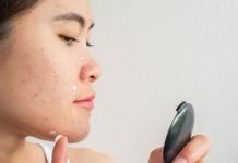 Remedies for common skin issues