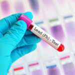 Health officials urge awareness of childhood lead poisoning