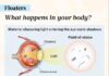 Floaters: Symptoms, causes, treatments, and natural approaches