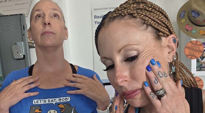 Healthy Habits: Skin wrinkles – Causes, prevention & tips